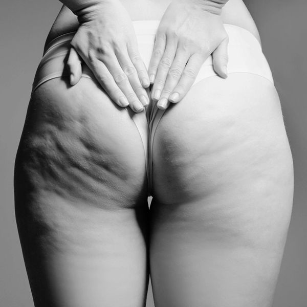 Lichaamsbehandeling - Cellulite